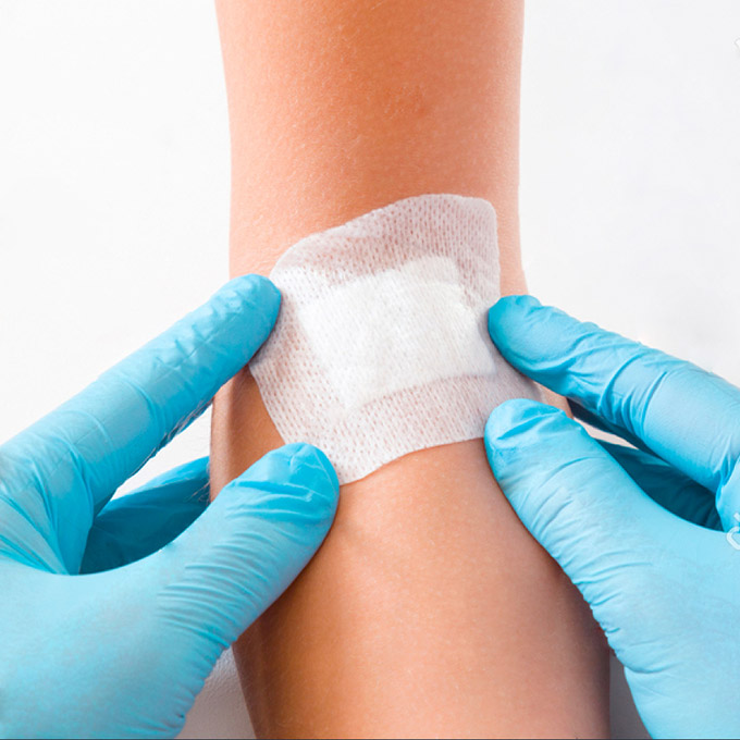 Medical Adhesive